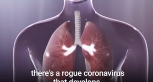 Što koronavirus radi vašem tijelu – od organa do organa